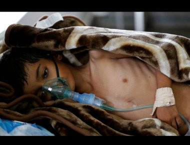 Υεμένη: Η Σαουδική Αραβία «σπρώχνει» τους κατοίκους σε λιμό χολέρας